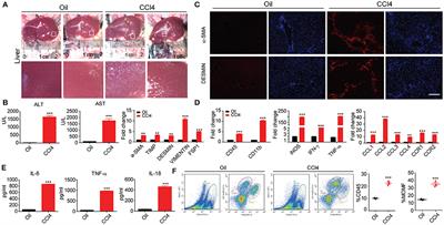 miR-20a-5p/TGFBR2 Axis Affects Pro-inflammatory Macrophages and Aggravates Liver Fibrosis